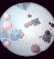 Salt-tolerant Archaea