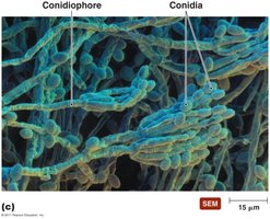 Fungal conidiophores and conidia SEM image