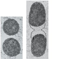 Normal and plasmolyzed bacterial cells