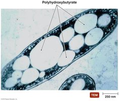 Granules of PHB in the bacterium Azotobacter chroococcum