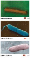 Micrographs of basic arrangements of bacterial flagella