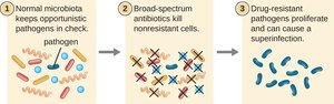Development of superinfection after broad-spectrum antibiotic use