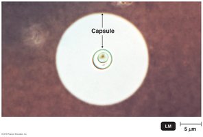 Cryptococcus capsule under microscope