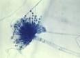 Aspergillus under microscope