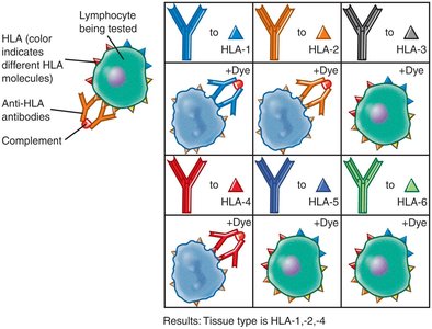 Tissue typing, a serological method