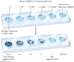 Agglutination Titration Test