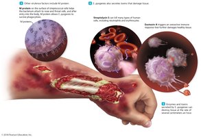 Further illustration of necrotizing fasciitis pathogenesis