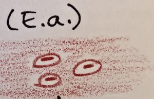 Microscopic appearance of Enterobacter aerogenes with capsule halo