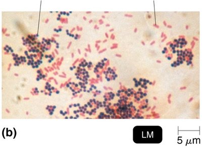 Gram-positive and gram-negative bacteria under microscope