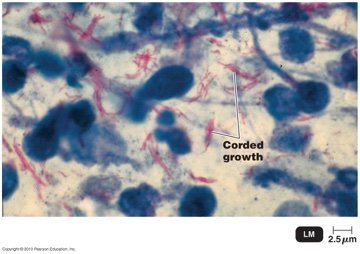 Atypical cell walls: Acid-fast bacteria
