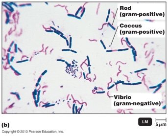 Gram-stained bacteria showing color differences