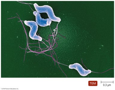 Campylobacter jejuni