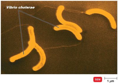 Vibrio cholerae