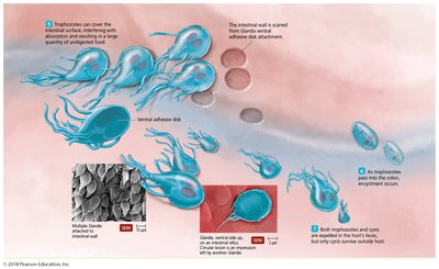 Giardia trophozoites and cysts in the intestine