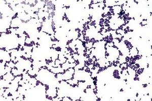Staphylococcal foodborne illness