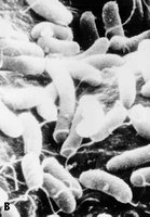 Mechanism of cholera toxin action