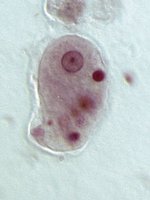 Amoeba under the microscope