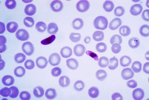 Plasmodium in blood smear