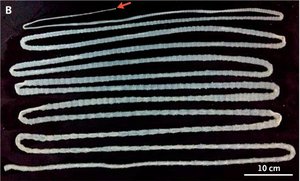 Tapeworm in the intestine
