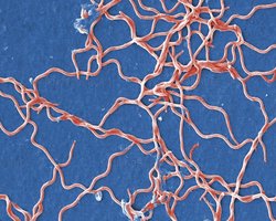 Spiral-shaped bacteria