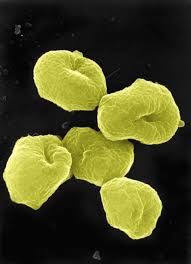 Archaea under the microscope