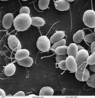 Archaea in extreme environment