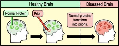 Effect of prions on brain health