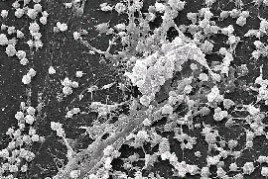 Microscopic image of Staphylococcus aureus biofilm