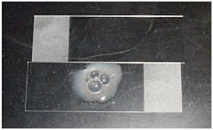Catalase test showing bubbling from hydrogen peroxide