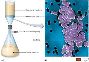 Filtration equipment and SEM of bacteria on a membrane filter