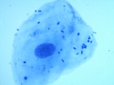 Human cheek cell with resident bacteria