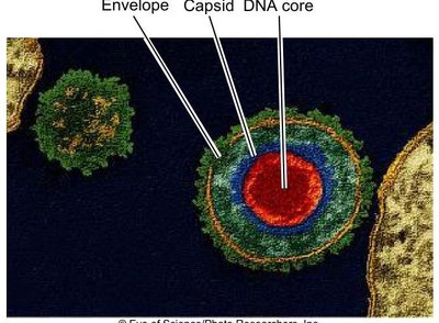 Electron micrograph showing viral attachment to host cell