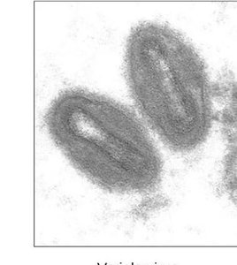 Electron micrograph of a complex virus (poxvirus)