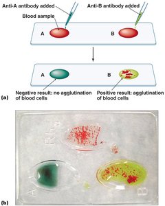Use of hemagglutination to determine blood types