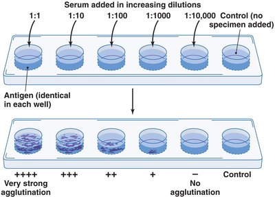 Use of agglutination to quantify antibody in a sample