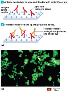 The indirect fluorescent antibody test