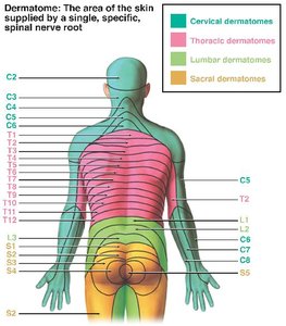 Dermatome map for shingles