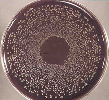 B. pertussis growth on Bordet-Gengou agar