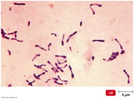 Corynebacterium diphtheriae, clubbed cells