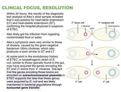 ETEC clinical focus and horizontal gene transfer