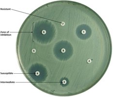 Kirby-Bauer disk diffusion test showing zones of inhibition