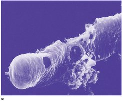 Damaged bacterial cell wall after beta-lactam treatment