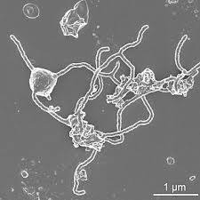 Electron micrograph of Asgard archaea