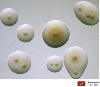 Distinctive 'fried egg' appearance of Mycoplasma colonies