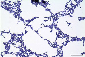 Bacteria under microscope