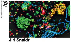 Microbial community in sewage sludge