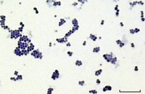 Staphylococcus aureus under microscope