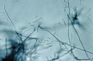 Streptomyces under microscope