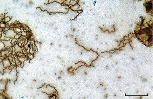 Treponema pallidum under microscope