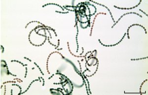 Anabaena under microscope